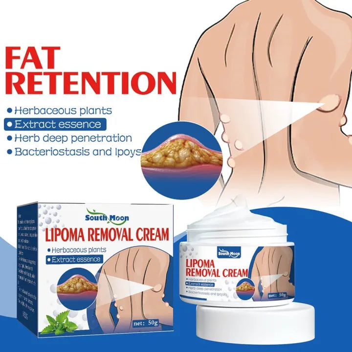 South Moon Lipoma Removal & Body Smoothing Cream - 50g